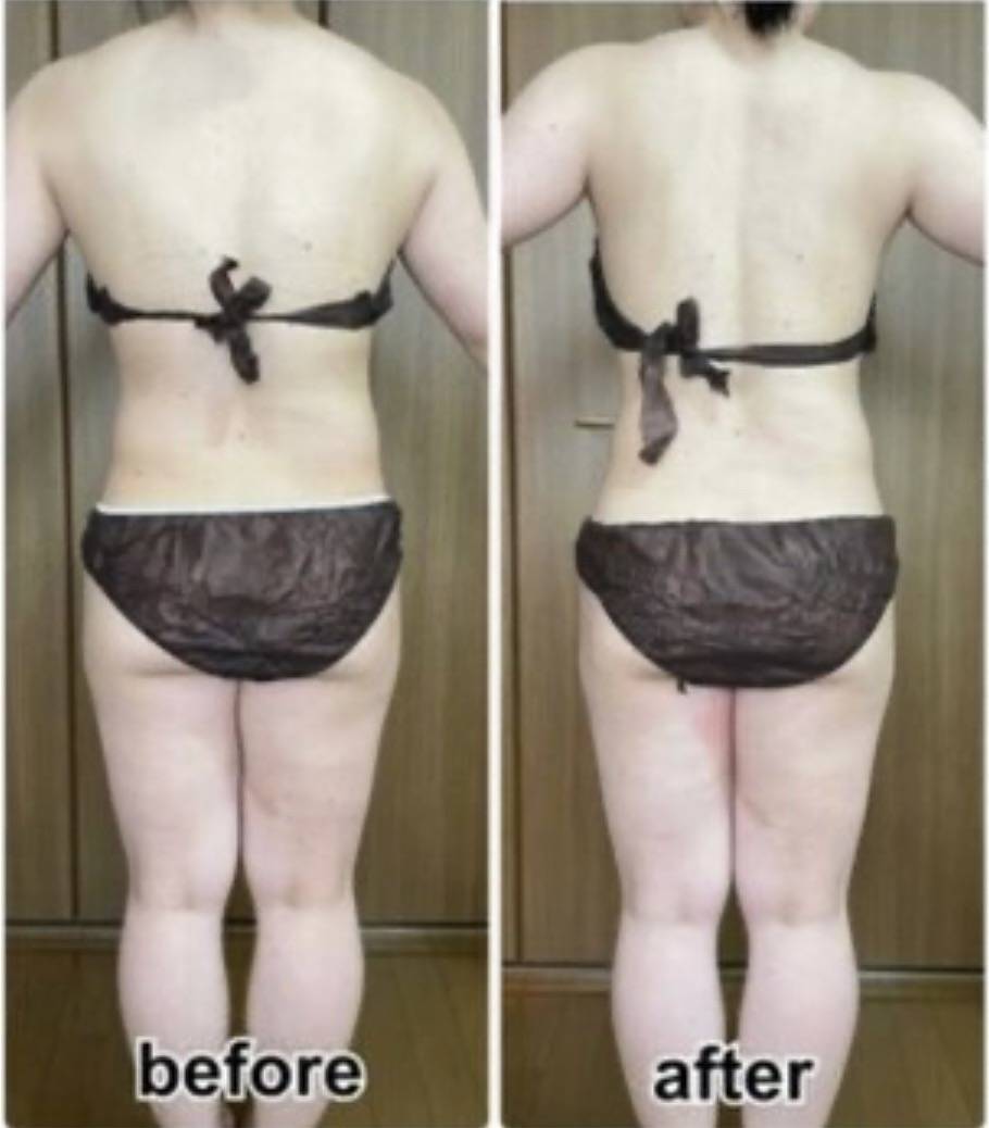 掲載許可をいただいた後ろ姿のビフォーアフター写真