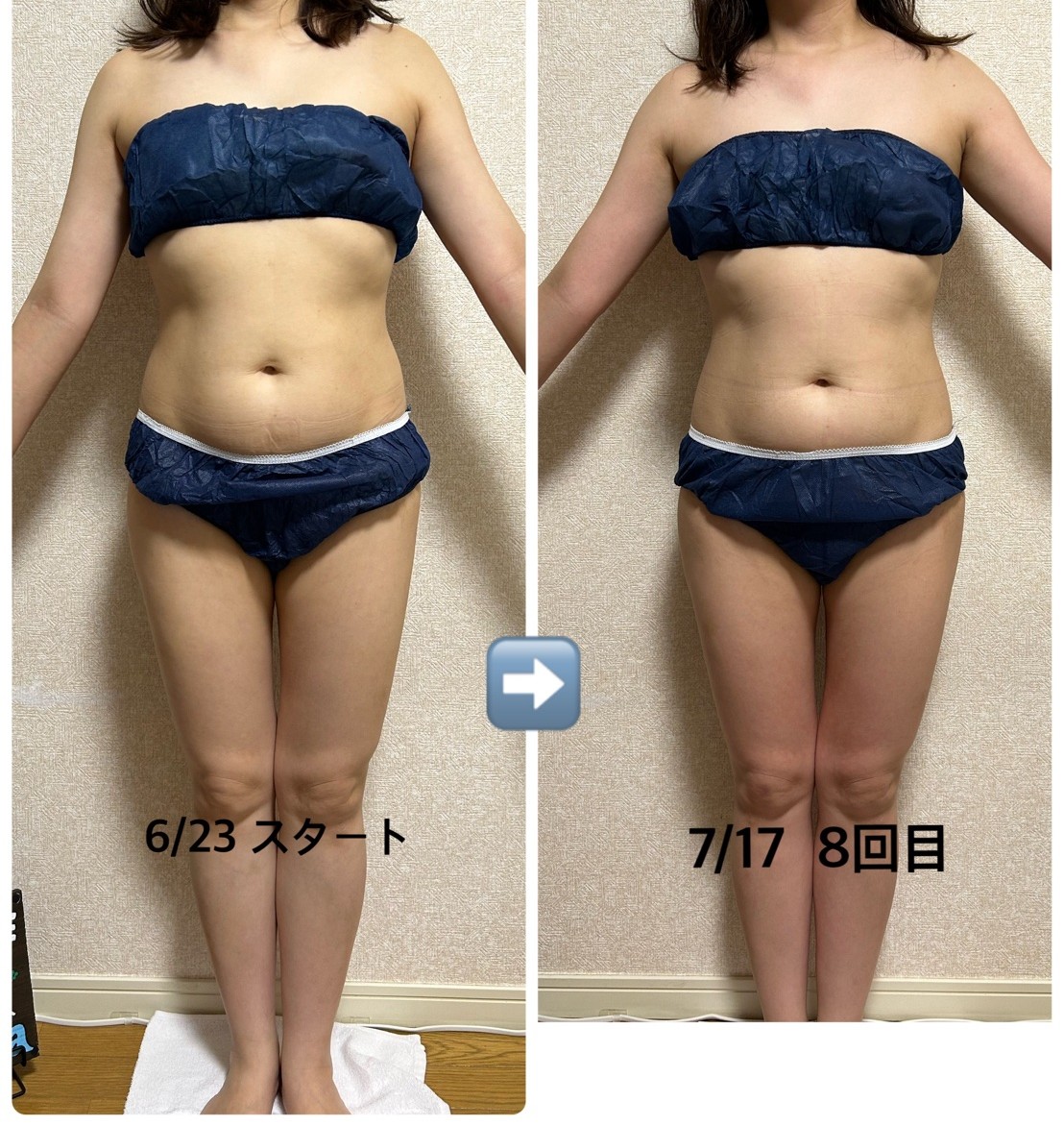 掲載許可をいただいた全身ラインのビフォーアフター写真